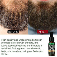 Beard Oil, Nourishing Moisturizing Spray Facial Hair Treatment Promotes Facial Growth And Thickening Liquid