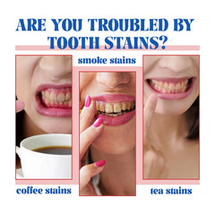 Probiotic Brightening Toothpaste, Oral Cleaning Remove Odor Stains White Teeth Gum Care Toothpaste