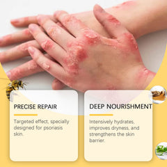 Skin Care Cream Moisturizing Herbal Cool Soothing Moisturizing Anti-Dandruff Moisturizing Gentle Skin Care
