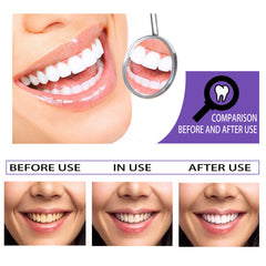 Teeth Whitening Toothpaste, Removing Teeth Stains And Odors Oral Care Brightening And Whitening Teeth Toothpaste