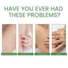 Firming Collagen Body Cream Moisturizes And Repairs Chicken Skin, Prevents Dry, Tender And Smooth Skin, Brightening And Beautifying Skin
