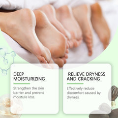 Hand And Foot Urea Cream Hydrates And Moisturizes Foot Skin To Prevent Cracking And Drying Foot Cream