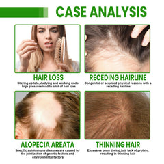 Hair Root Spray, Repair Dry Hair Fickle Hair Tight Hair To Prevent Smooth Hair