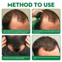Men's Hair Serum For Hair Stabilization Nourishes And Nourishes Your Hairline