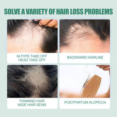 7 Days Essence Gently Moisturizes Hydrating Hairline Scalp Root Nourishing Hair Care Essential Oil