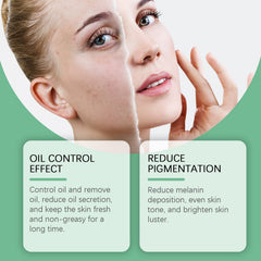 Azelaic Acid Essence Cream, Repair Moisturizing Moisturizing Face Oil Control Moisturizing Mild Refreshing Cream