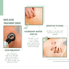 Body Acne Removal Cleanser Spray, Deep Clean Back Arm Fade Acne Beauty Moisturizing Spray