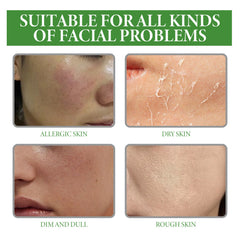 Aloe Vera Serum, Repair Dry Skin Moisturizes And Hydrates To Lighten Pimples And Seal Delicate Pores