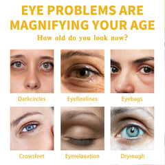 Vitamin E Eye Cream, Lightened Dark Circles Crow's Feet, Firmed And Moisturized Eye Cream