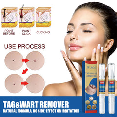Skin Kayo Pen Gentle Body Tag Remover Cleansing Skin Care Pen