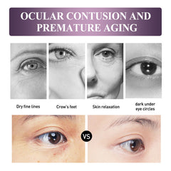 Electric Anti-Wrinkle Eye Cream Lifts, Strengthens, Moisturizes And Reduces Fine Lines, Bags And Dark Circles Under Eye Care