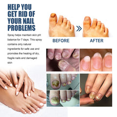 Nail Care Spray Gently Cleans Foot Nails Moisturizing And Brightening Nail Care Spray