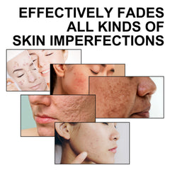 Multi Function Face Serum, Moisturize And Soften Fine Lines And Wrinkles