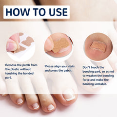 Nail Correction Patch, Nail Insert Correction And Repair Toe Manicure Nail Patch