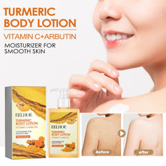 Turmeric Body Lotion, Moisturizing And Moisturizing Whitening Skin Refreshing And Brightening Winter Skin Care Body Lotion