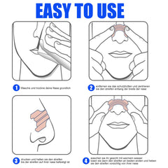 Relieves Nasal Obstruction Nasal Dilation Discomfort Relieves Sleep Disorders Snoring Nose Ventilation Patch