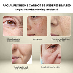 Collagen Anti-Aging Serum, Fade Fine Line Collagen Recombination Anti-Aging Serum