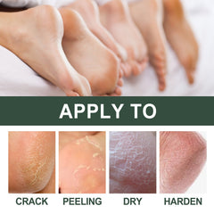 Anti-Crack Hand And Foot Care Cream Moisturizes Skin To Prevent Dry Cracking, Peeling, Freezing And Chapping