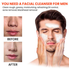 Men's Volcanic Face Wash, Acne Blackhead Face Deep Clean Pores And Oil Control