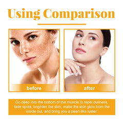 Ouhoe Fruit Acid Facial Body Essence Series, Moisturizing, Moisturizing, Brightening And Firming Skin Essence