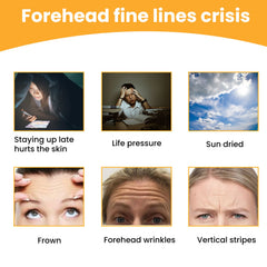 Forehead Wrinkle Patch, Lifts Lightens And Smooths Forehead Wrinkles Facial Skin Forehead Patch