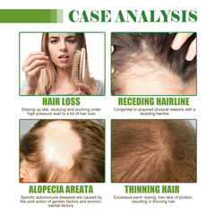 Hair Care Essential Oil Moisturizes And Protects Dry Hair, Moisturizes And Softens Hair Care Essential Oil