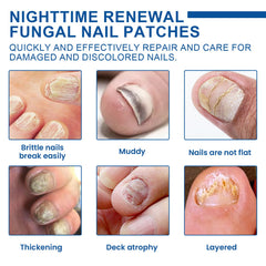 Nighttime Renewal Fungal Nail Patches, Repair And Thickening Gray Nail Insert Soft Nail Care Patch