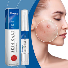 Acne Care Pen, Gently Clean Acne And Acne Closing Skin Daily Care Solution