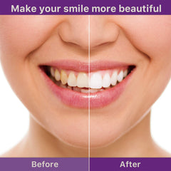 Tooth Cleaning Mousse, Anti-Decay Clean Teeth Tartar Breath Fresh Whitening Teeth Toothpaste