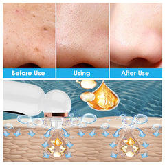 New Hailicare Small Bubble Suction Blackhead Instrument Skin Pore Cleaner Water Oxygen Circulation Skin Cleaning Instrument