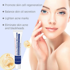 Herbal Acne-Clearing Cream Face Refreshing Oil Control Gentle Pore Cleansing Cream