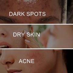 Dark Spot Whitening Cream, Lightening Yellow Brown White Spot Cream Dark Spots Correct Skin Tone Moisturize Skin Whitening