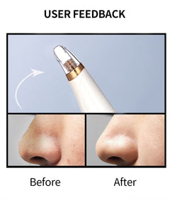 Blackhead Remover Face Deep Pore Cleaner Removal Vacuum Suction Facial SPA Diamond Beauty Care Tool Skin Care