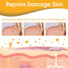 Bee Venom Wart Treatment Spray Improves Pimples, Moles, Repairs and Smooths Skin Wart Treatment Spray