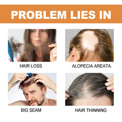Mypa Ampoule, Strengthen And Repair Hair, Prevent Hair Loss, Strengthen Hair Root And Thicken Hair And Scalp Massage Solution