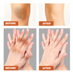 Black Wattle Essential Oil, Repair Underarm Joint Black Whitening Skin Light Spots Skin Beauty Essence Oil