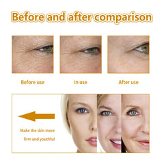 Collagen Anti-Wrinkle Serum, Hydrating And Smoothing Fine Lines, Firming Face And Elastic Moisturizing Skin Essence