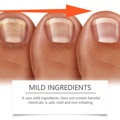 Nail Care Lotion Cleanses And Moisturizes Nails And Nails With A Gentle Conditioning Solution
