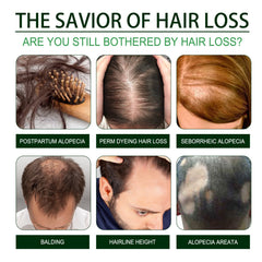 Black Castor Oil, Thickening Hair Repair Soft Massage Scalp To Strengthen Hair Strands