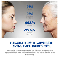 Dark Spot Repair Essence, Repair Acne Pimple Lightening Spot Fine Lines Moisturizing Firming Whitening Essence