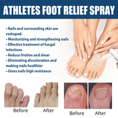 Athletes Foot Relief Spray, Relieve Foot Sweat Foot Itching Peeling Gray Nails Foot Odor Moisturizing Care Spray