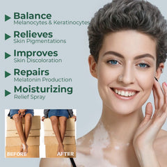 Vitiligo Relief Cream, Repair White Spots Flower Spots Skin Topical Care Ointment