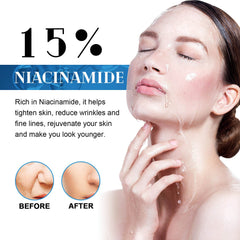 Niacinamide Facial Essence, Brightening, Firming, Hydrating And Whitening Essence