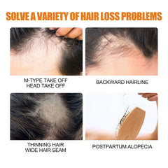 Hair Growth Spray, Men Hair And Beard Thickening Strengthening Anti-loss Care Solution