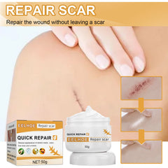 Desalting Skin Scar Cream, Skin Burn Scalding Surgical Scar Wound Repair Cream