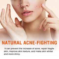 Salicylic Acid Facial Mask Gentle Cleansing Mask To Lighten Acne, Seal And Tighten Pores