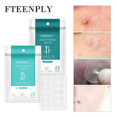 22Pcs/Sheet Acne Pimple Patch Invisible Acne Stickers Blemish Treatment Acne Master Pimple Remover Tool Skin Care