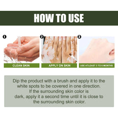 White Spot Purifying Serum For Whitening And Repairing White Spot Spot And Perspiration Spot Skin Moisturizing Serum