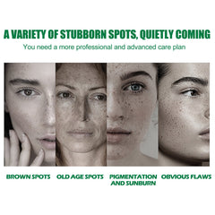 Dark Spot Correcting Glow Serum, Beauty Skin Stains Freckles Melanin Repair Dark Skin Care