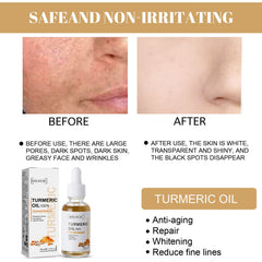 Turmeric Correction Essence Facial Care Hydrating Moisturizing Gentle Moisturizing Skin Care Essence